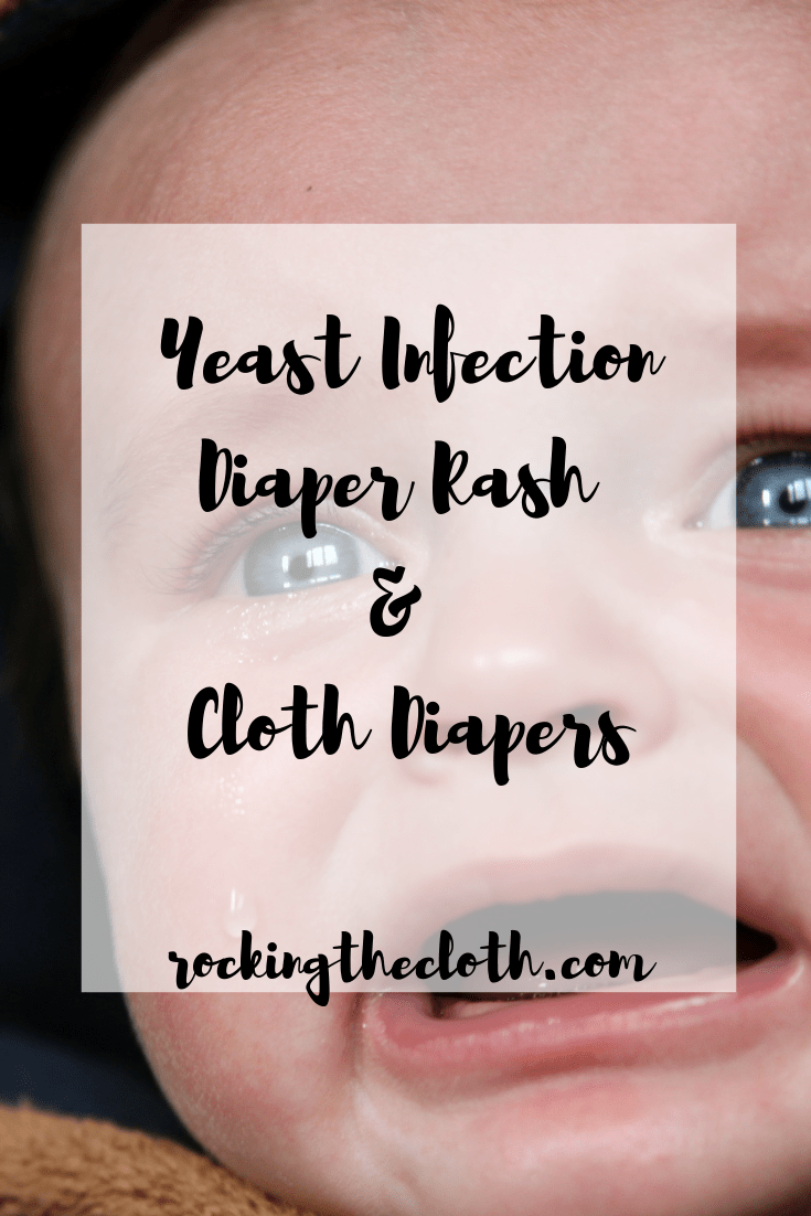 Yeast Infection Diaper Rash & Cloth Diapers | Rocking the ...